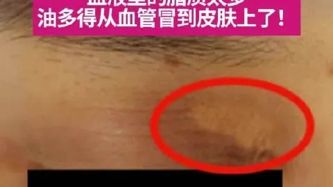 湖人引援分析：新援提升传球与投篮，加速球队进攻步伐